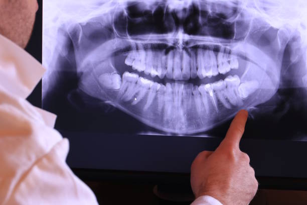 Best Emergency Tooth Extraction in Webb City, MO